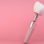 15% Descuento en Implantes Dentales